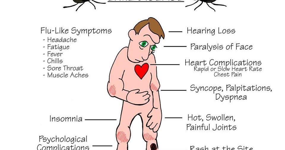 Het menselijk lichaam en eerste hulp . Symptomen van de ziekte van Lyme.