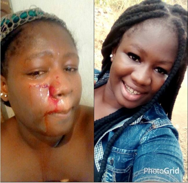 Girl Receives Maximum Beating On Valentine’s Day Instead Of Gifts (Photos)