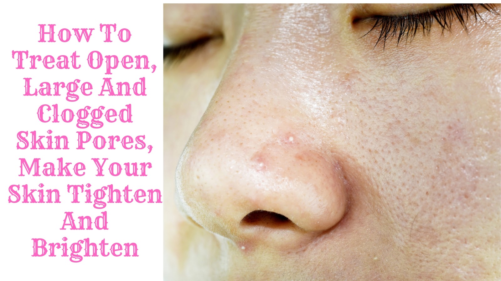 How To Treat Open, Large And Clogged Skin Pores, Make Your Skin Tighten