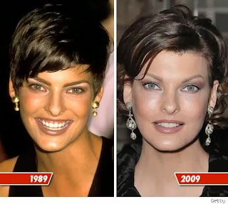 Linda Evangelista Plastic Surgery Before and After Photo
