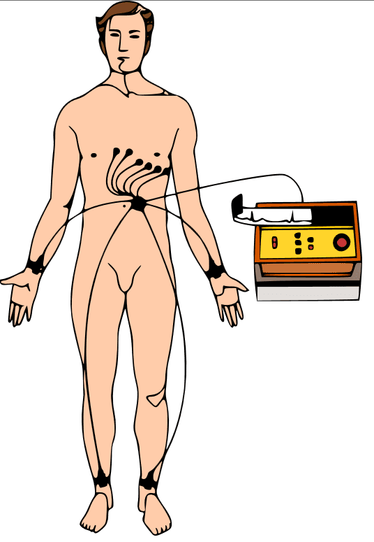 Electrocardiograma: derivaciones de miembros y precordiales