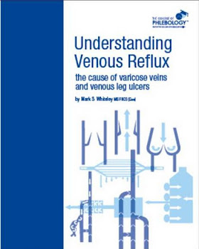 Understanding Venous Reflux - The Cause of Varicose Veins and Venous Leg Ulcers