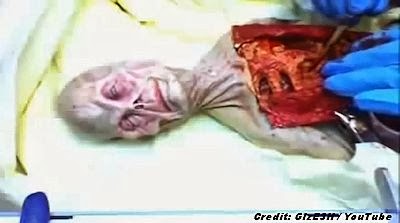 Shocking Video of Alien Autopsy in Russia in 1969