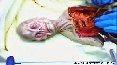 New Twist In Decades Old Alien Autopsy Controversy | (GRAPHIC) VIDEO