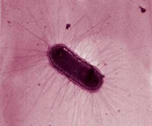 Enteropathogenik Escherichia coli (EPEC) Enteropathogenik Escherichia coli (EPEC)