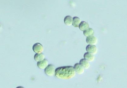 Fourteen cyanobacterial cells
