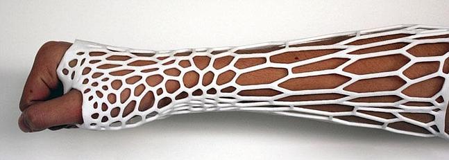 Nuevos tipos de escayolas