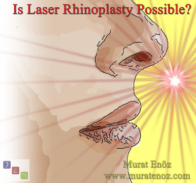 Laser-assisted nose reshaping, Laser nose correction, Laser rhinoplasty, Nasal bone remodeling with laser, Rhinoplasty with laser, Nose job with laser, Laser nose job,