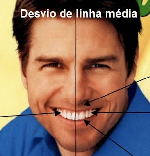 desvio de linha média