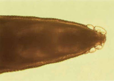 Head of the Enterobius vermicularis adult female worm