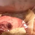 Σοκαριστικό βίντεο....  Από πελάτη στα Lidl που τραβάει βίντεο τα μυρμήγκια και τις κατσαρίδες να κάνουν βόλτες μέσα στα ψωμιά (ΒΙΝΤΕΟ)