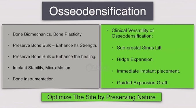 OSSEODENSIFICATION: Optimize the Site, Optimize the Outcome - Dr. Salah Huwais