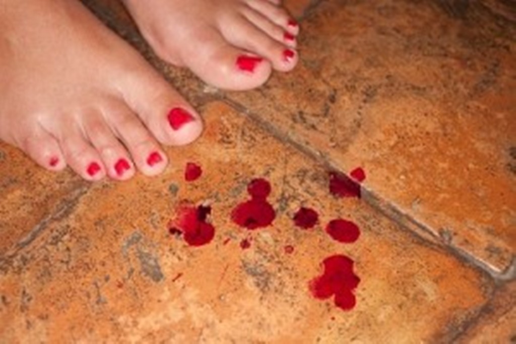 causes of bleeding in women