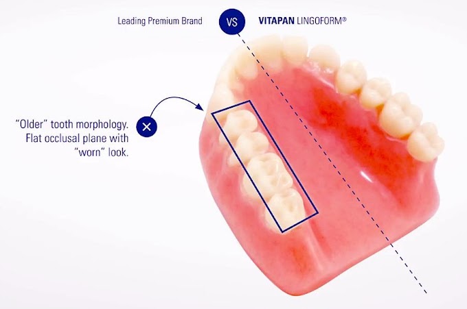 PROSTHODONTICS: VITAPAN EXCELL® Anterior Denture Teeth 