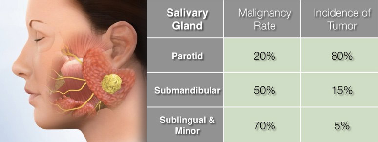 pleomorphic adenoma of submandibular gland pdf