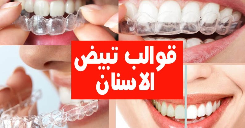 صواني تبييض الأسنان Razocaran Izvanredan Spavaonica Pearline Goldstandardsounds Com