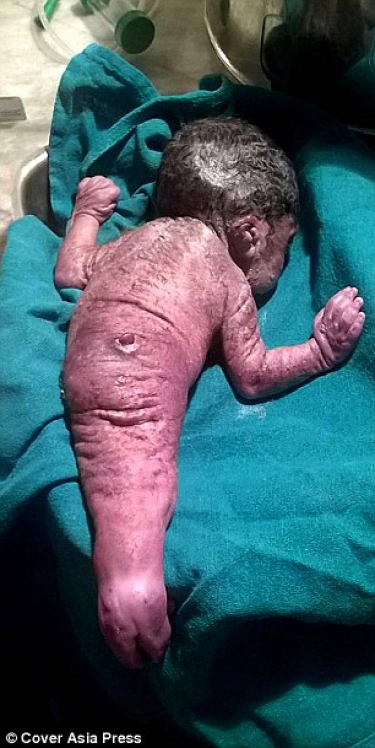 A woman gives birth to a baby mermaid