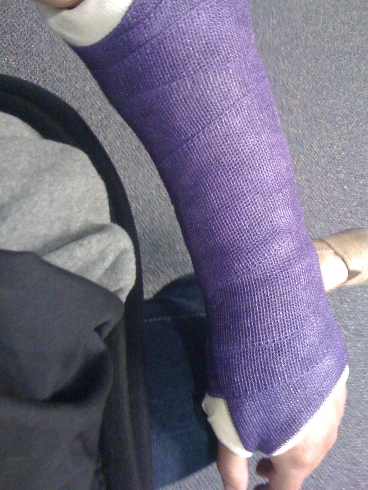 The day i broke my arm essay 04 image