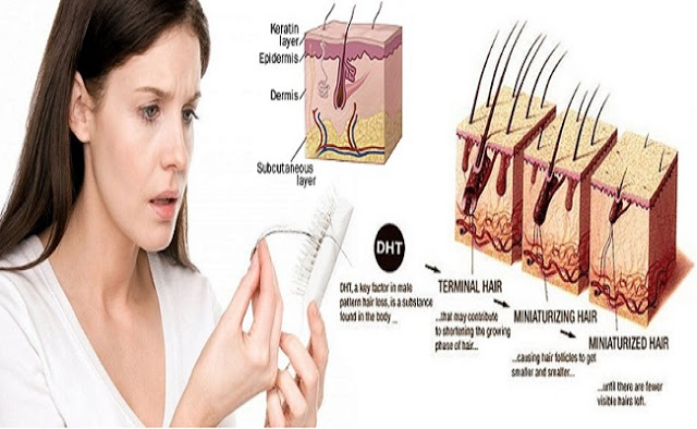 how to prevent female hair loss naturally how to prevent female hair loss naturally