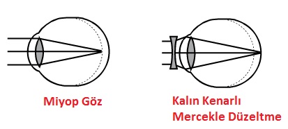 Goz Kusurlari 7 Sinif Fen 2015 2016