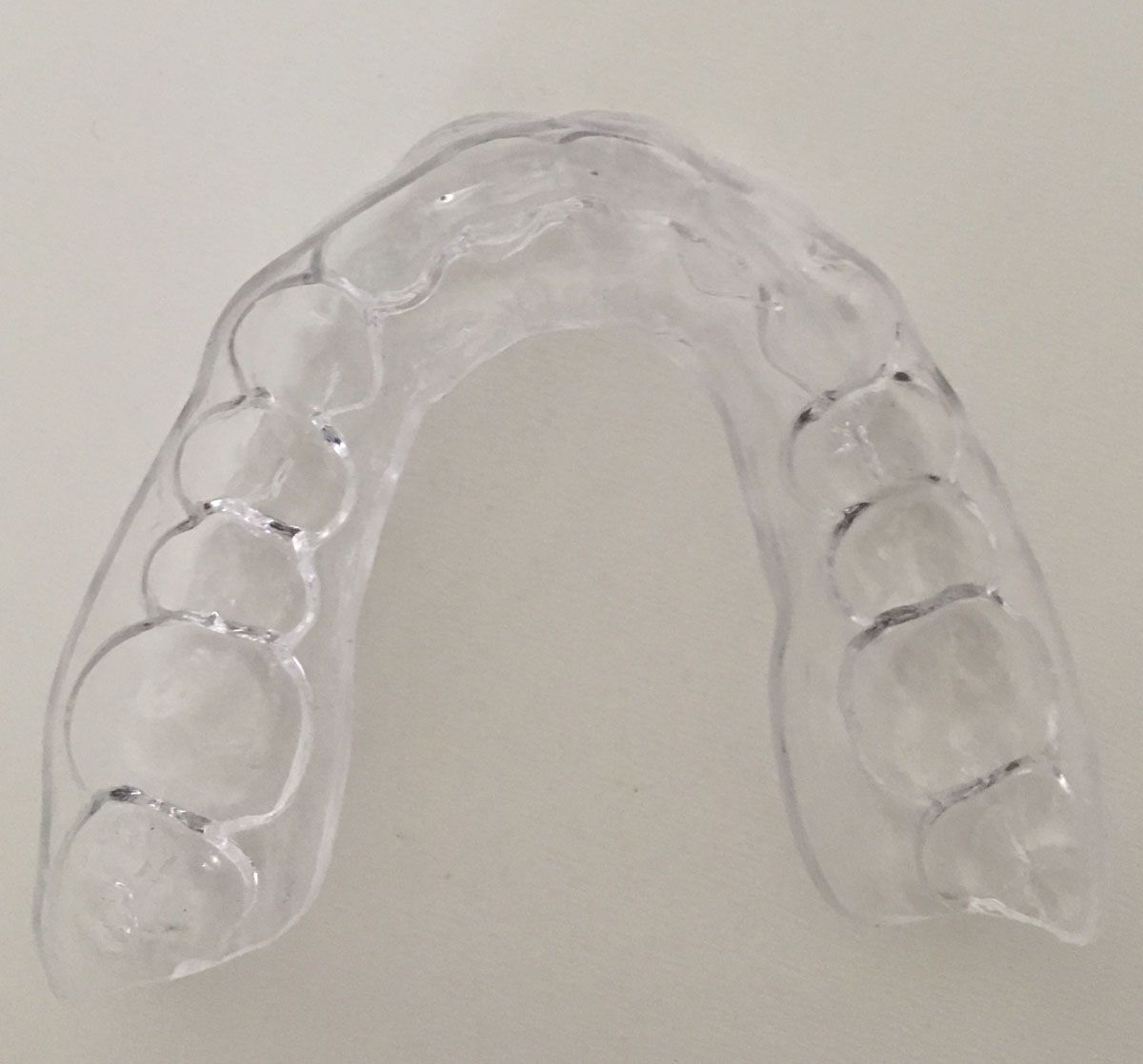 Orthodontie adulte bouche en chantier juin 2018