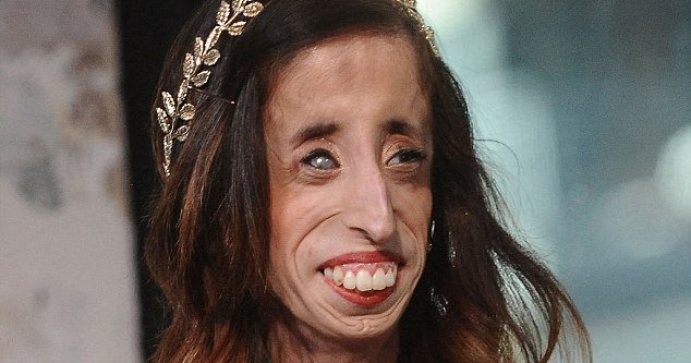 A woman who was once branded the ugliest in the world has spoken out about ...
