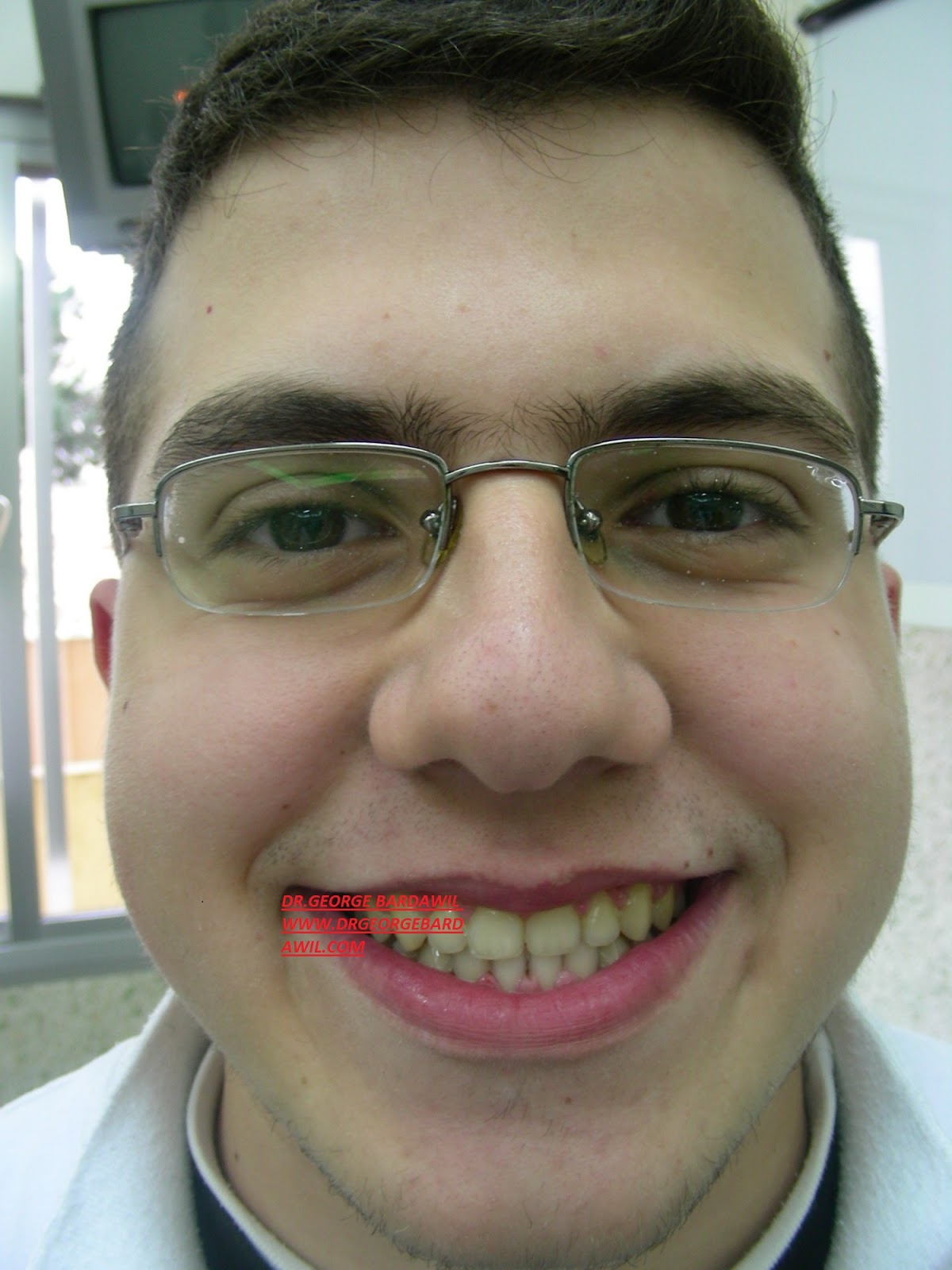 E. BardawilOrthodontistInvisalign Diamond level Non