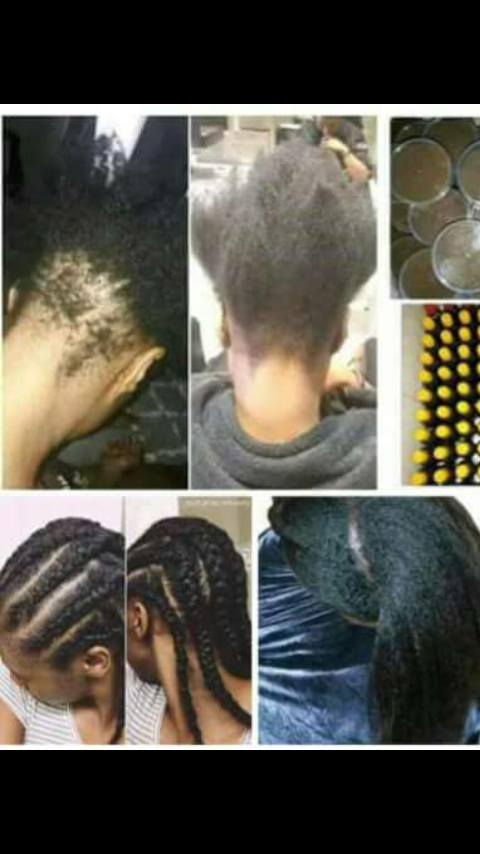 Compelling Adverts Best Dandruff Removal And Natural Hair Growth