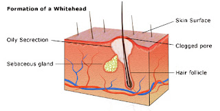 formation of whiteheads