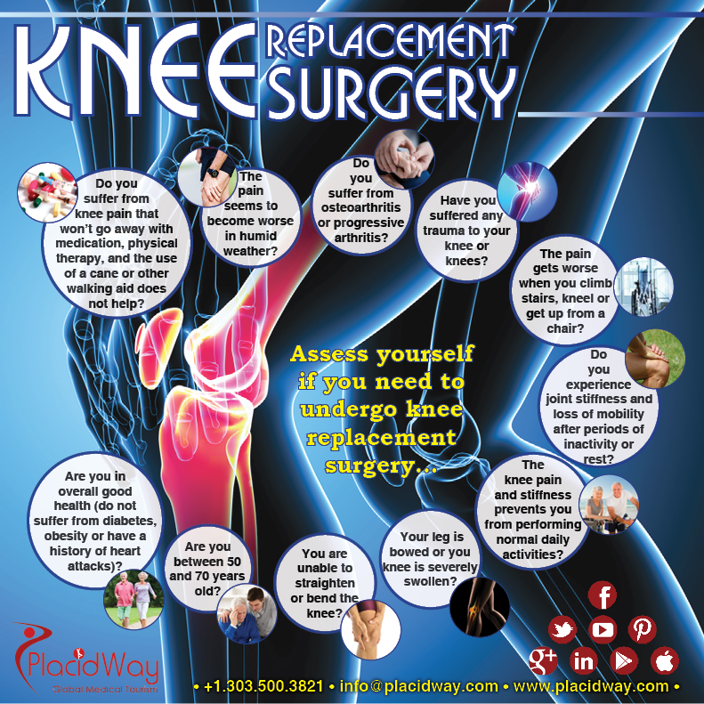 Orthopedics Worldwide Knee Replacement Surgery