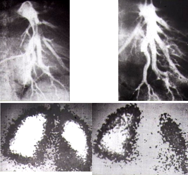 SCDATS Instrumental diagnosis