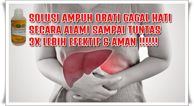 Cara Mengobati Gagal Hati Secara Alami