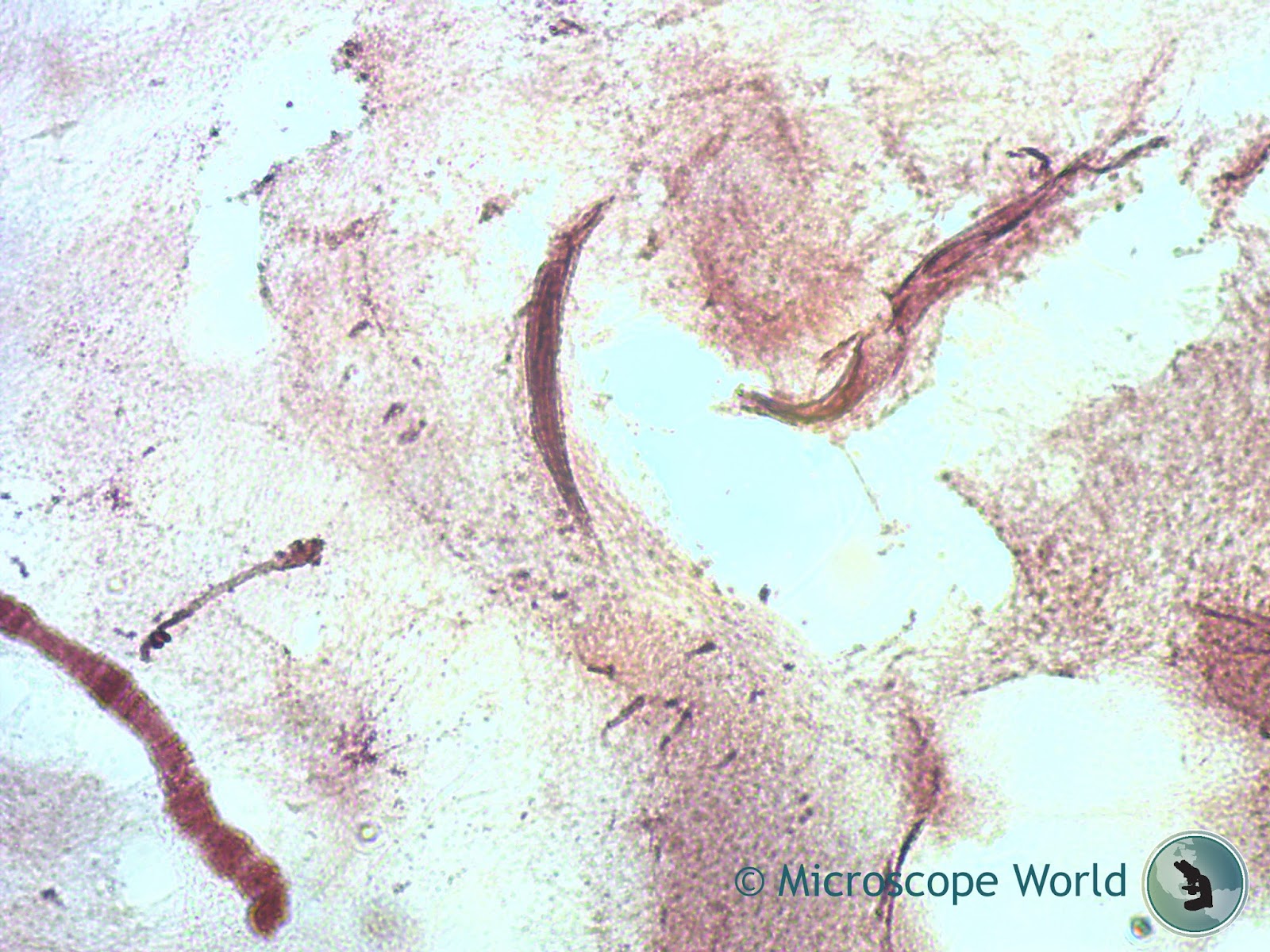 Microscope World Blog Chromosomes under the Microscope