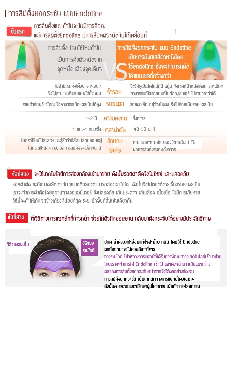 surgery_methods_eye_endotine_02.jpg