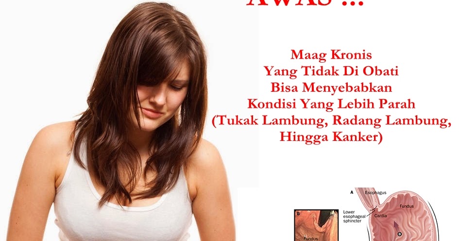 Ciri Ciri Penyakit Asam Lambung Kronis - Ini Cirinya