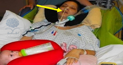 أصيبت بالشلل بعد ولادة ابنتها الى كل حامل 