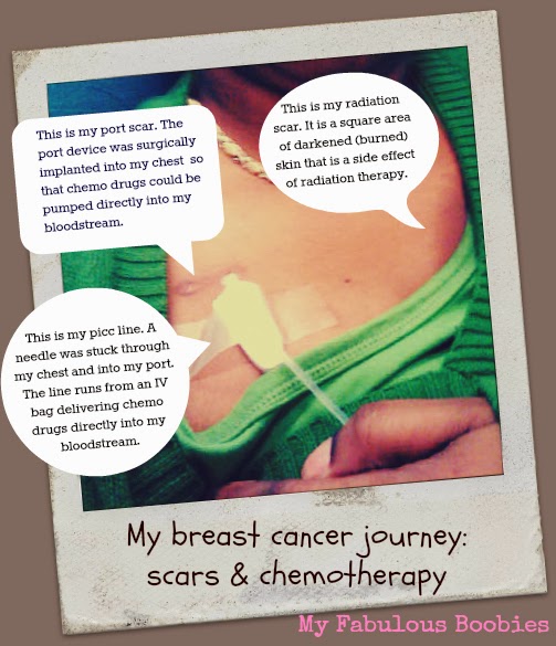 breast cancer scars infographic (My Fabulous Boobies blog)