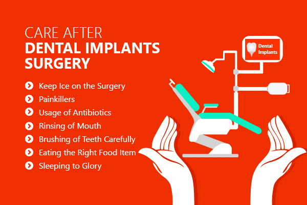 Care after Dental Implants Surgery