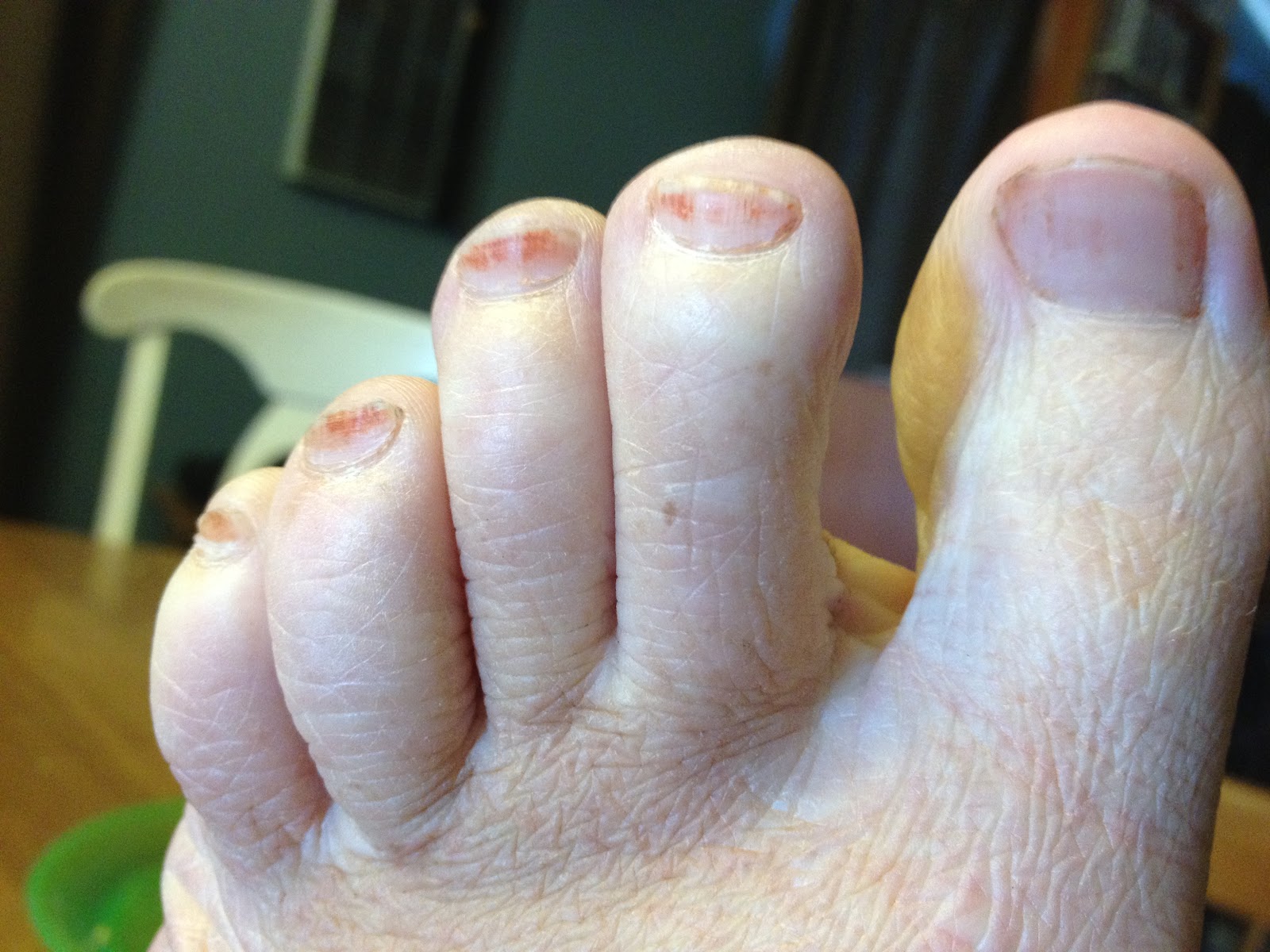 Love Everyday Update on my well water that turns everything orange