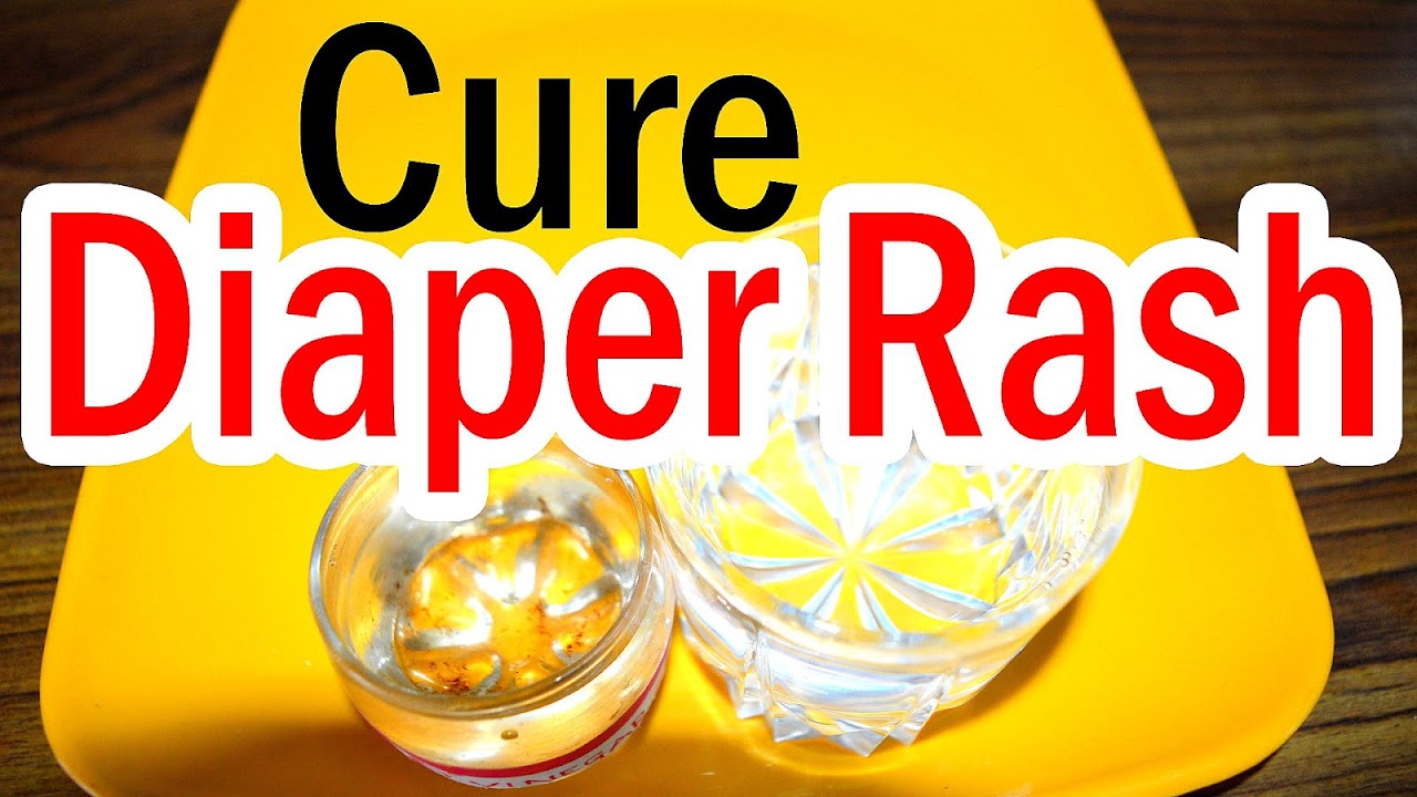 Diaper Rash Treatment Home Remedies Diaper Choices