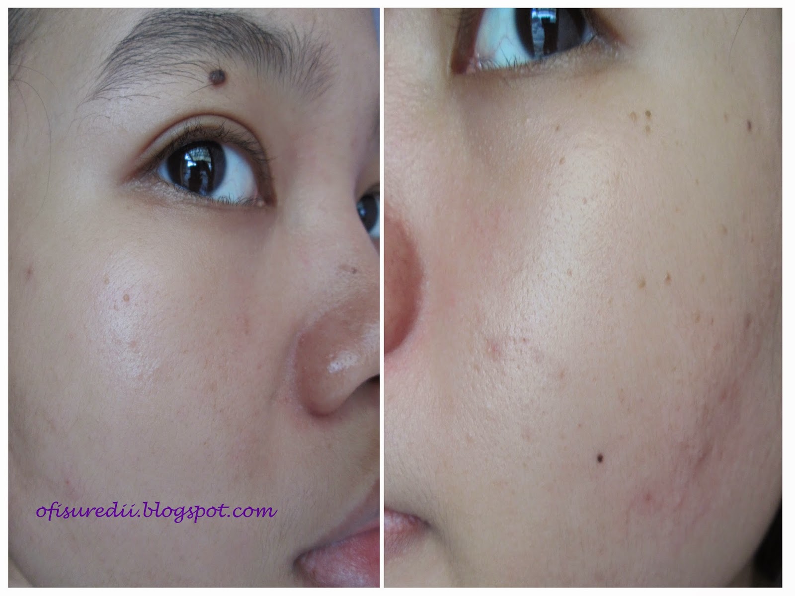 clinique laser focus