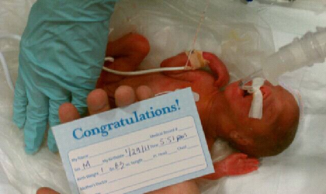 Dallas Preemie Parents Dallas Preemie Parents Photo Gallery Dallas Preemie Parents Dallas Preemie Parents Photo Gallery