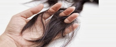 kuru saclarin nedenleri