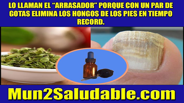 Lo llaman el “arrasador” porque con un par de gotas elimina los hongos de los pies en tiempo record. Lo llaman el “arrasador” porque con un par de gotas elimina los hongos de los pies en tiempo record.