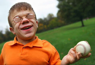 A patient living with a Hurler syndrome pictures