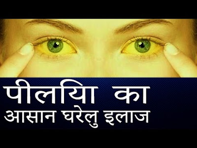 घरेलू उपचार से दूर करें शिशु में पीलिया घरेलू उपचार से दूर करें शिशु में पीलिया