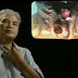 Obat untuk gejala kanker tenggorokan thumbnail