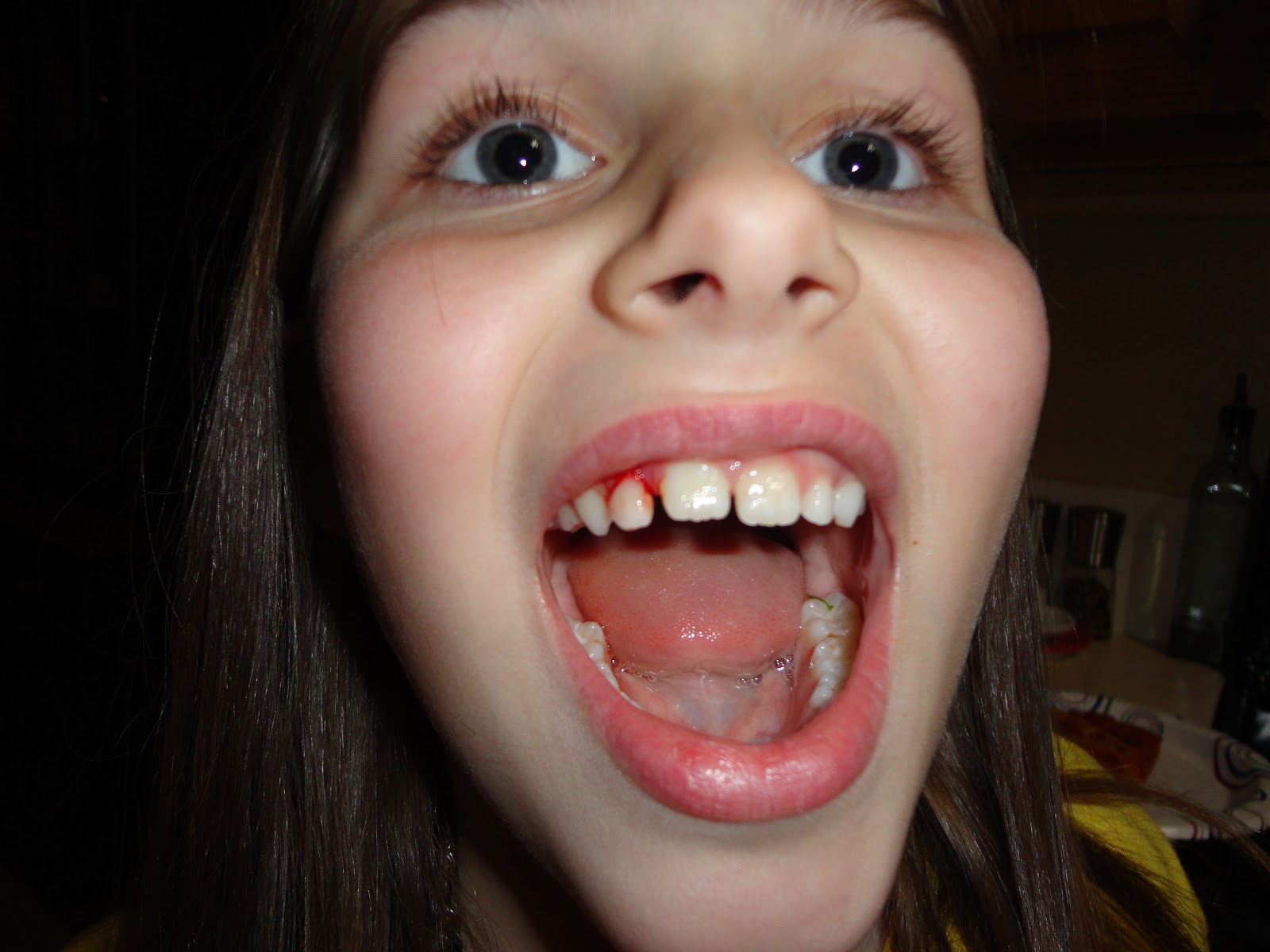 The Woodard Family relax and pull teeth