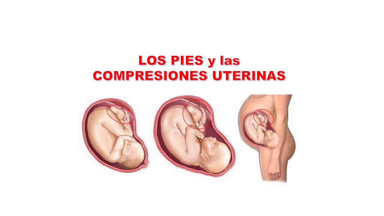 PIE EQUINO PIE EQUINO VARO y PIE ADUCTO ¿PORQUÉ?