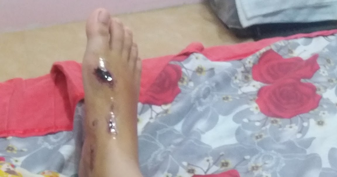 Motor Habis Jatuh - Homecare24